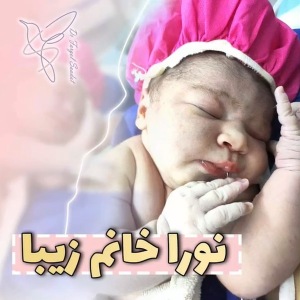 زایمان-سزارین-28