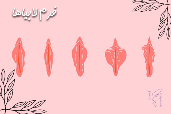 لابیاپلاستی در تهران - دکتر سعادت