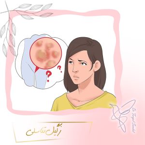زگیل تناسلی - دکتر سعادت
