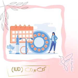 IUD-دکتر فرگل سعادت