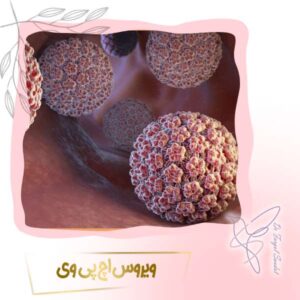 ویروس اچ پی وی