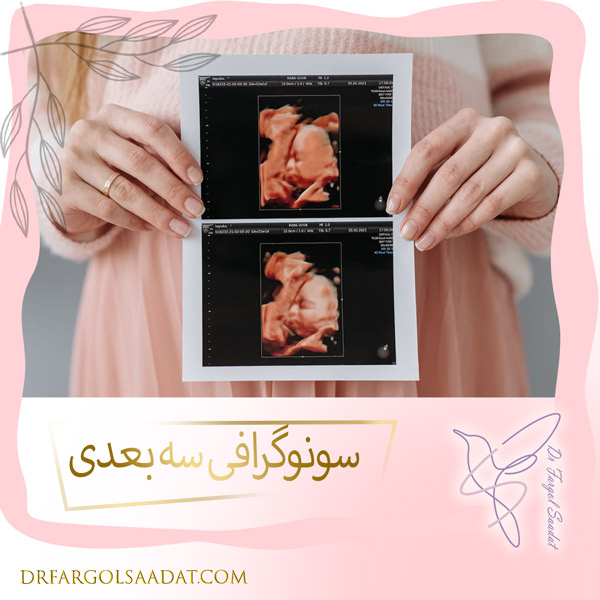 سونوگرافی سه بعدی https://drfargolsaadat.com/
